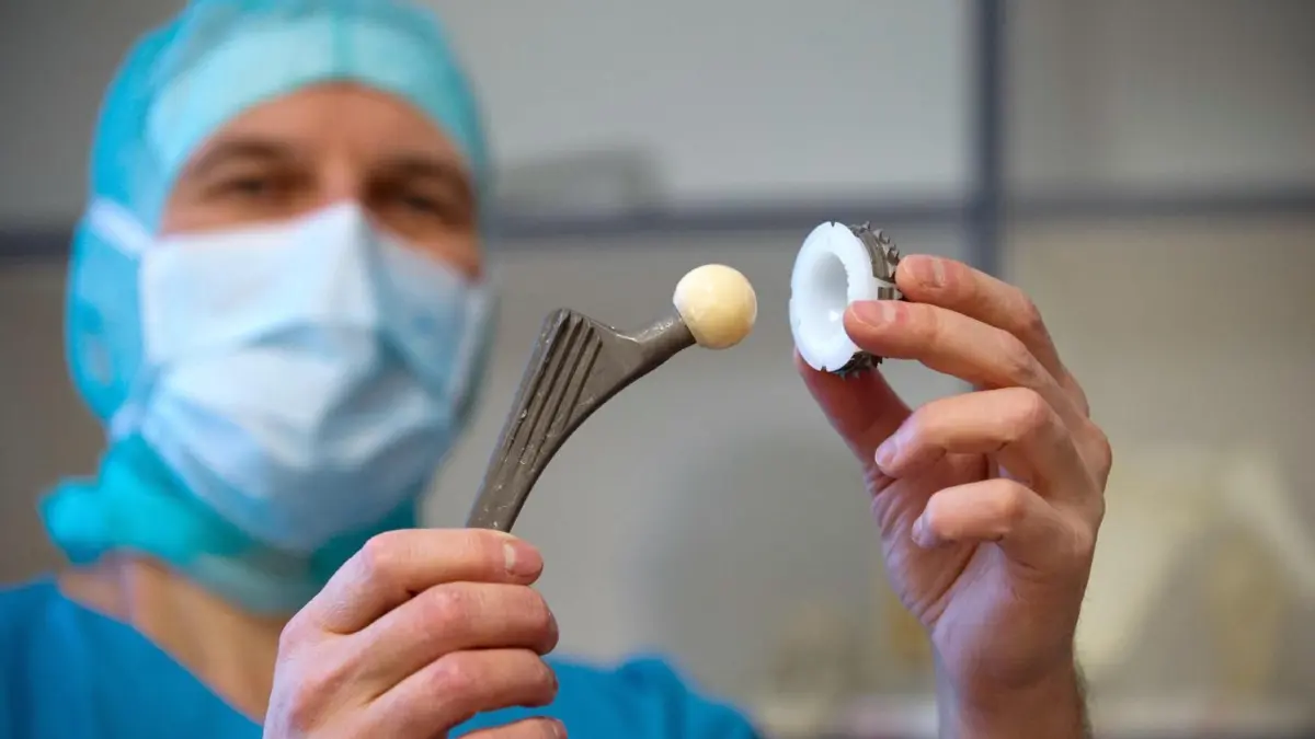 Wird in Deutschland oft eingesetzt: ein künstliches Hüftgelenk. ⇥