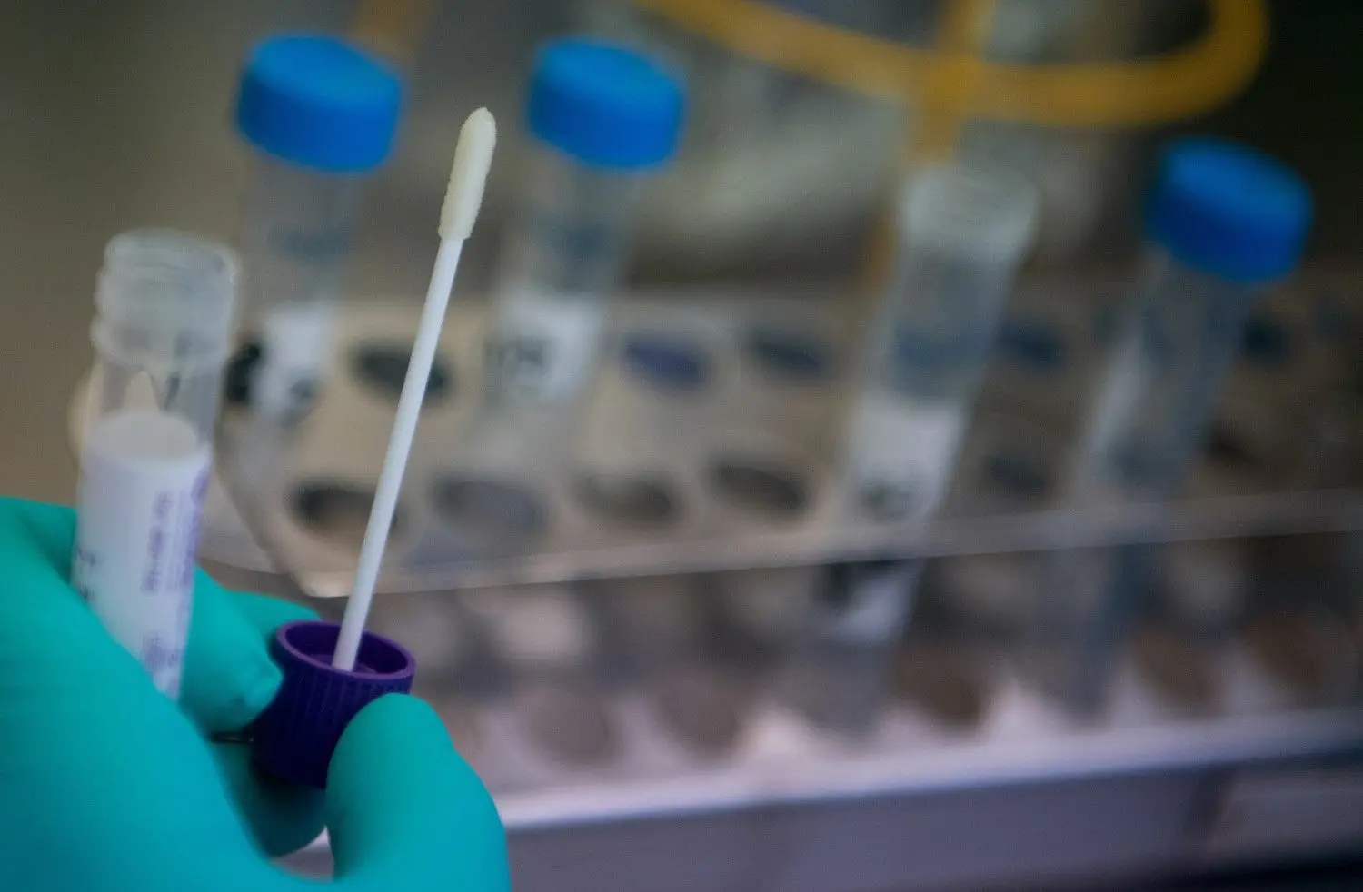 Eine Mitarbeiterin des Landesgesundheitsamts Baden-Württemberg hält einen Abstrich eines Covid-19 Verdachtsfalles aus Baden-Württemberg in der Hand.