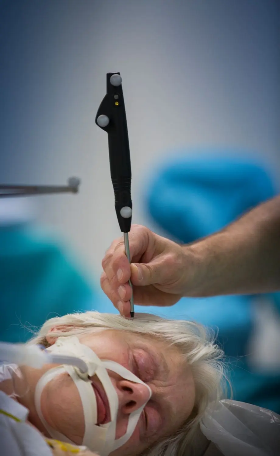 Mit einem Stift wird die Bohrung auf dem Schädelknochen vorgezeichnet. Rechts der Tumor in Großaufnahme.