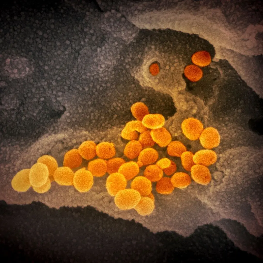 Eine elektronenmikroskopische Aufnahme des „U.S. National Institute of Health“ zeigt das Coronavirus (SARS-CoV-2), das aus der Oberfläche von im Labor kultivierten Zellen austritt. Das Virus passt sich durch Mutationen ständig seinem neuen Wirt, dem Menschan an.