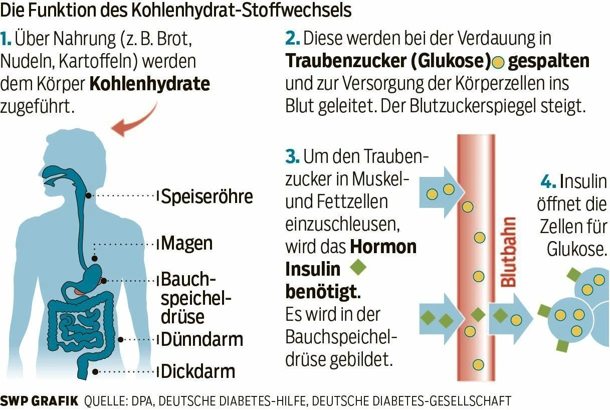 Gesundheit Insulin Pumpe Nicht jeder bekommt sie   swp.de