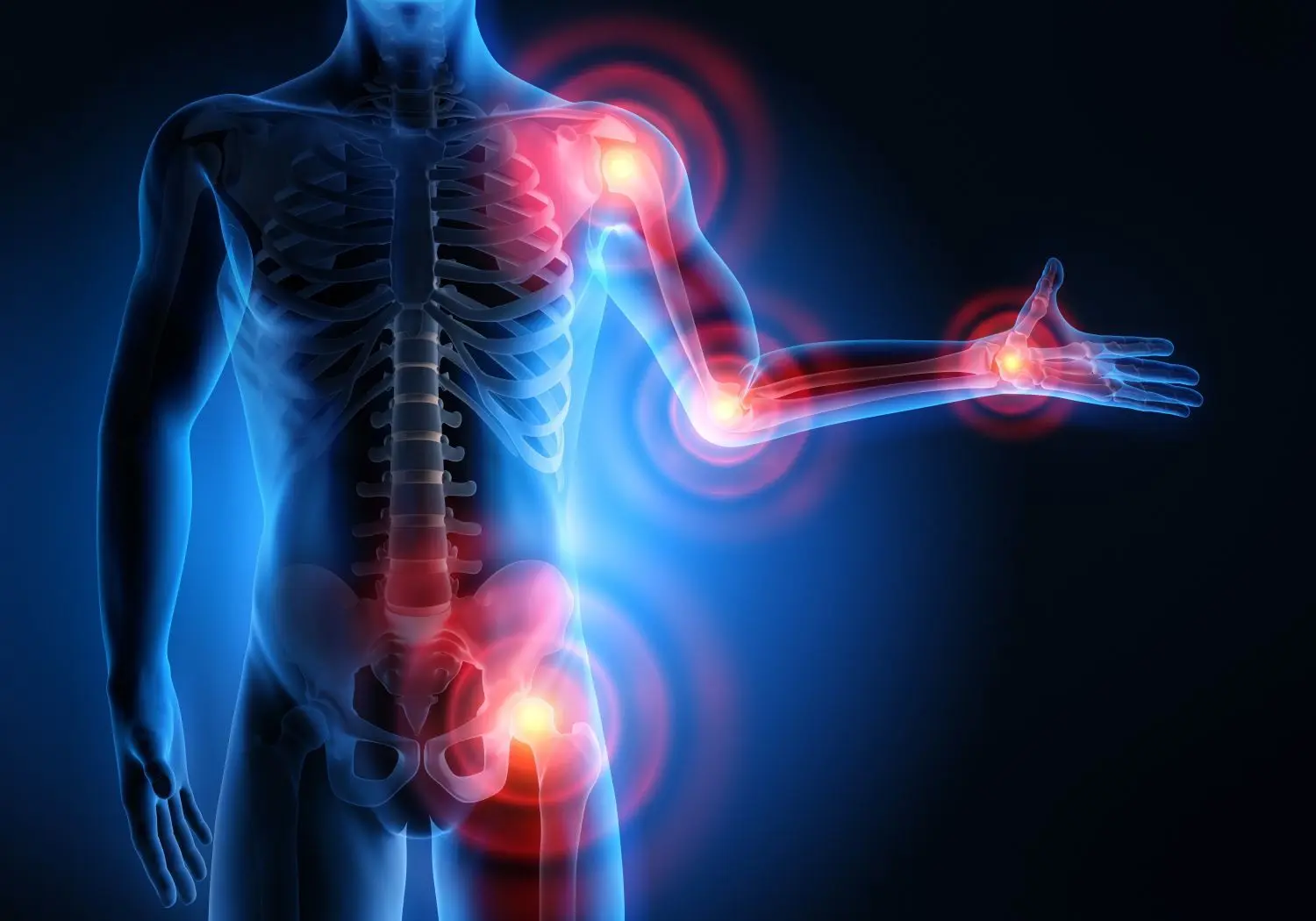 Die betroffenen Patienten sind in ihrem Alltag oft stark eingeschränkt, weil Bewegungen weh tun: Diese Darstellung eines Skeletts veranschaulicht Schmerzkrankheiten, Entzündungen und Rheuma.