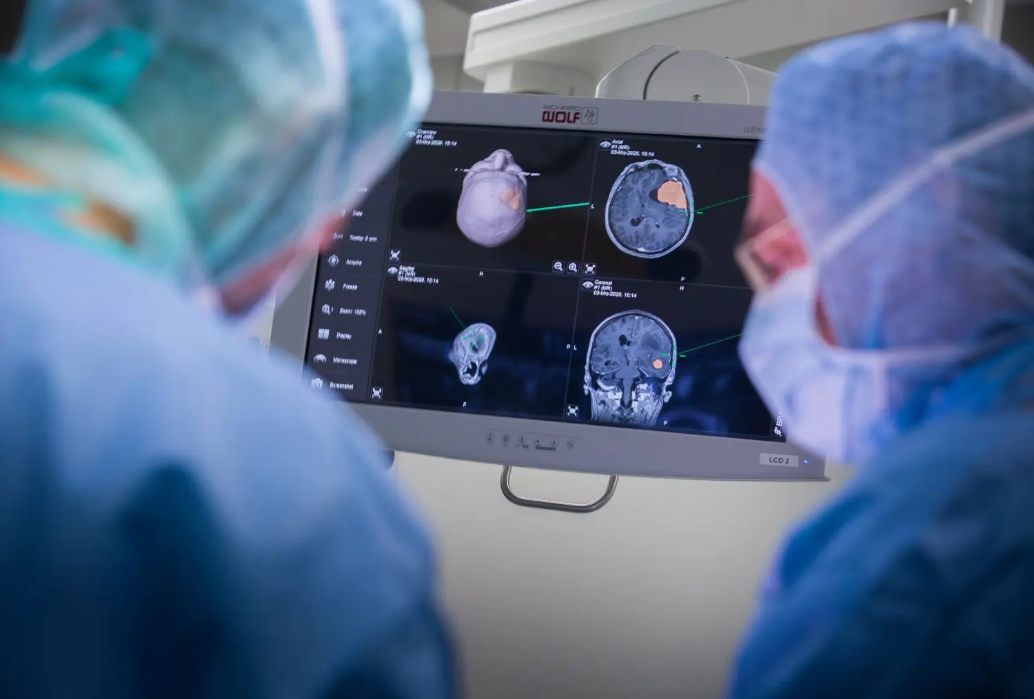 Wie am Navigationsgerät: Am Monitor können die Operateure den Tumor als gelben Fleck erkennen.