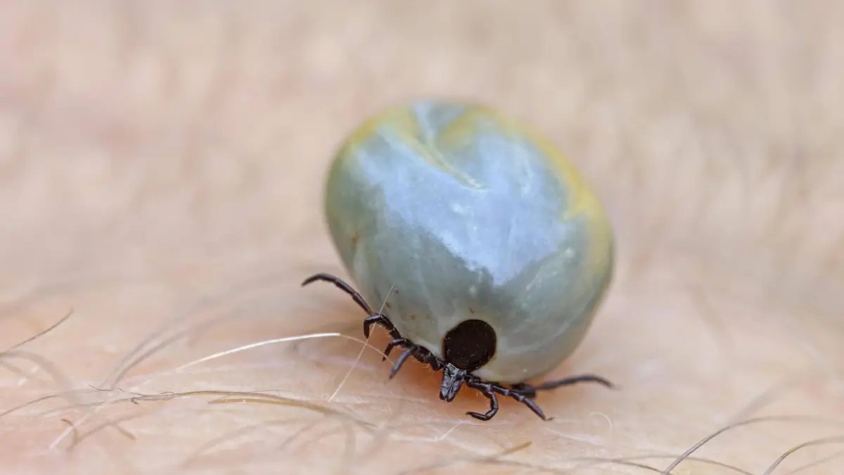 Gemeiner Holzbock Ixodes ricinus auf der menschlichen Haut kann Borreliose und zeckenbedingte Enzephalitis verursachen *** Common Holzbock Ixodes Ricinus at the human Skin can Lyme disease and Tick-borne Encephalitis cause Copyright: imageBROKER/alimdix/xArterrax/xSvenxErikxArndt ibltsm09995477.jpg Bitte beachten Sie die gesetzlichen Bestimmungen des deutschen Urheberrechtes hinsichtlich der Namensnennung des Fotografen im direkten Umfeld der Veröffentlichung
