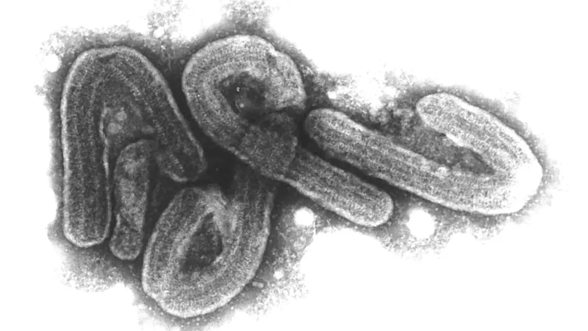 Marburg-Virus: ARCHIV - 07.08.2017, NA, Hamburg: ARCHIV - HANDOUT - Eine elektronenmikroskopische Aufnahme des Marburg-Virus (undatiertes Handout). Das Marburg-Virus gehört zu den gefährlichsten bekannten Krankheitserregern. (zu dpa: «Sechs Tote durch Marburg-Fieber in Ruanda») Foto: Bernhard-Nocht-Institut/dpa +++ dpa-Bildfunk +++