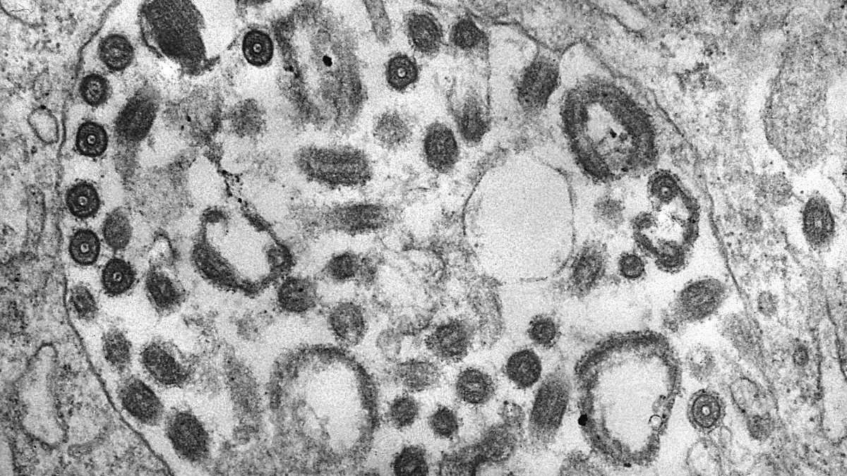 HANDOUT - Die Transmissionselektronenmikroskopie (TEM) einer Gewebeprobe zeigt das Vorhandensein zahlreicher Marburg-Viruspartikel. Der Ausbruch des oft tödlichen Marburg-Virus in Tansania ist vorbei. (Foto von 1975; zu "Tansania erklärt Marburg-Ausbruch für beendet") +++ dpa-Bildfunk +++