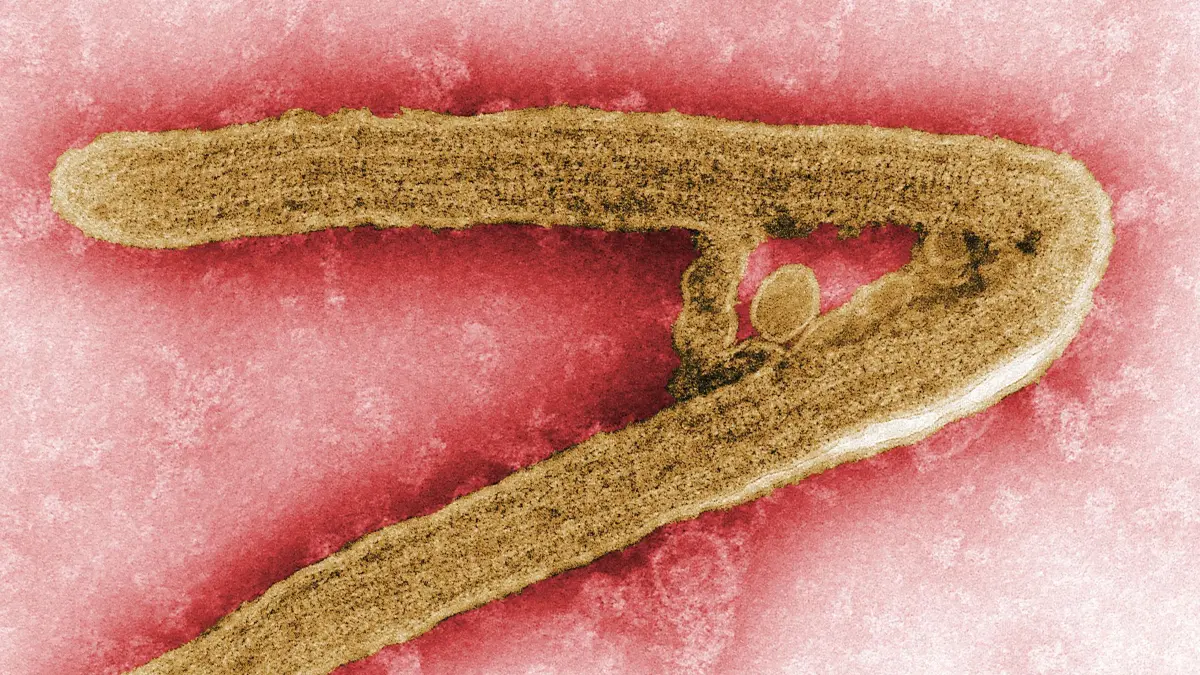 Das Marburg-Virus gehört zu den gefährlichsten bekannten Krankheitserregern.