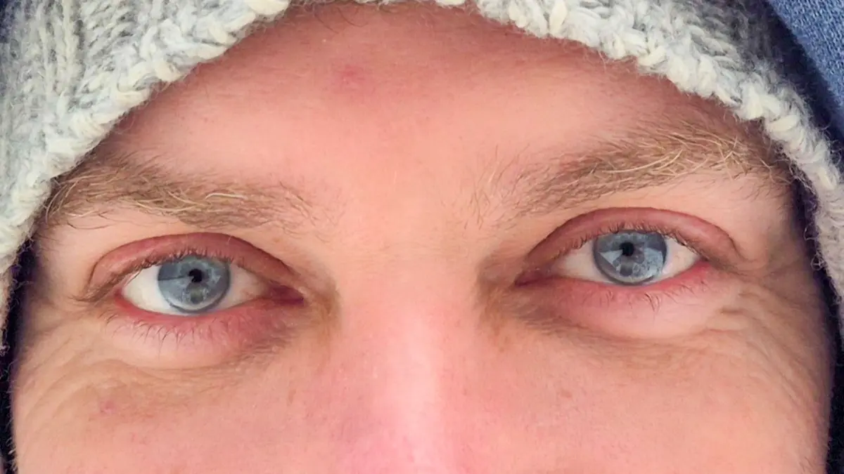 Blaue Augen - bei Schnee erscheinen sie uns oftmals noch viele blauer und leuchtender.