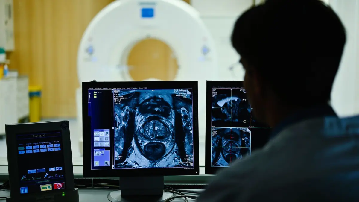 Mitarbeiter des DKFZ betrachtet Querschnittsbild einer Prostata: ARCHIV - Nach dem Anfangsverdacht: Im Verlauf einer Diagnostik kommen auch bildgebende Verfahren zum Einsatz. (zu dpa: «Prostatakrebs: Was Männer wissen sollten») Foto: Uwe Anspach/dpa/dpa-tmn - Honorarfrei nur für Bezieher des dpa-Themendienstes +++ dpa-Themendienst +++