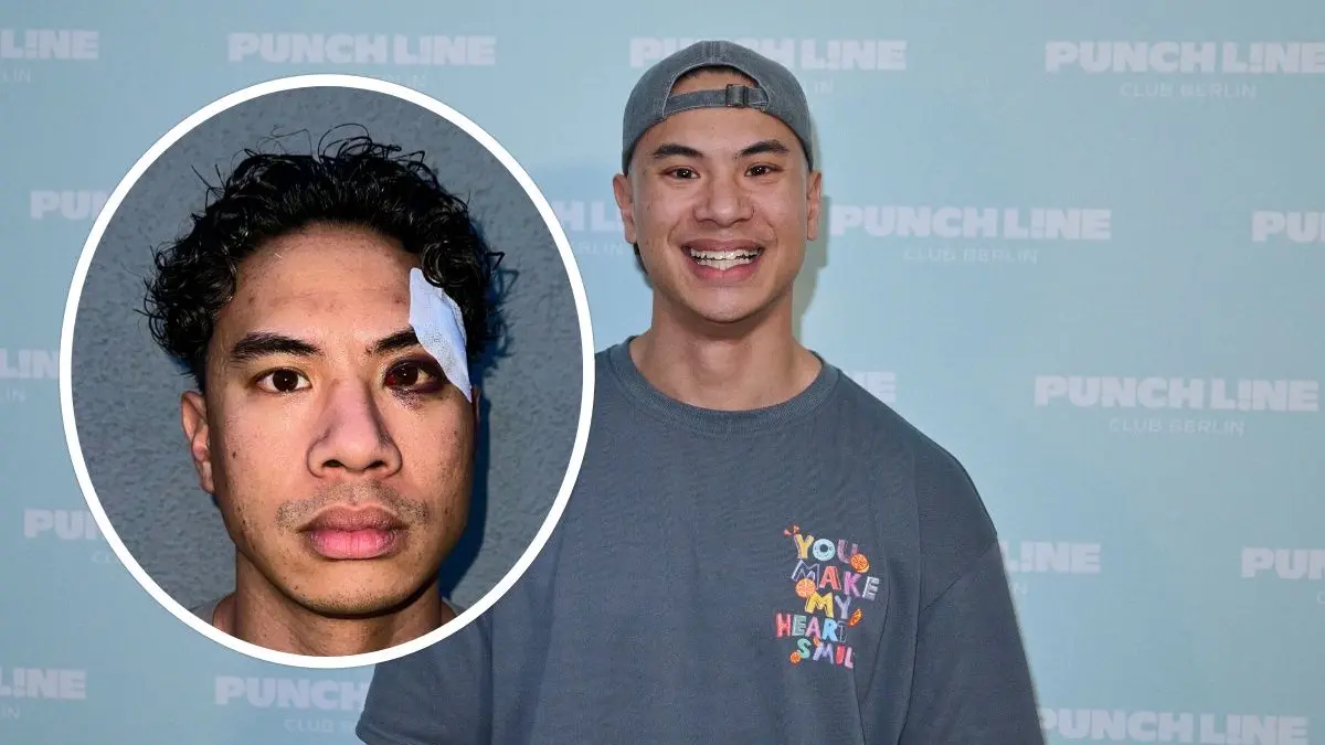 Racist attack on Tutty Tran: Comedy star beaten up in the street