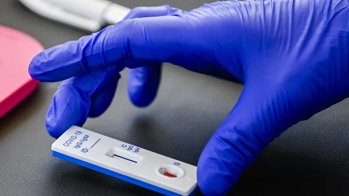 Ein Test für das Coronavirus.