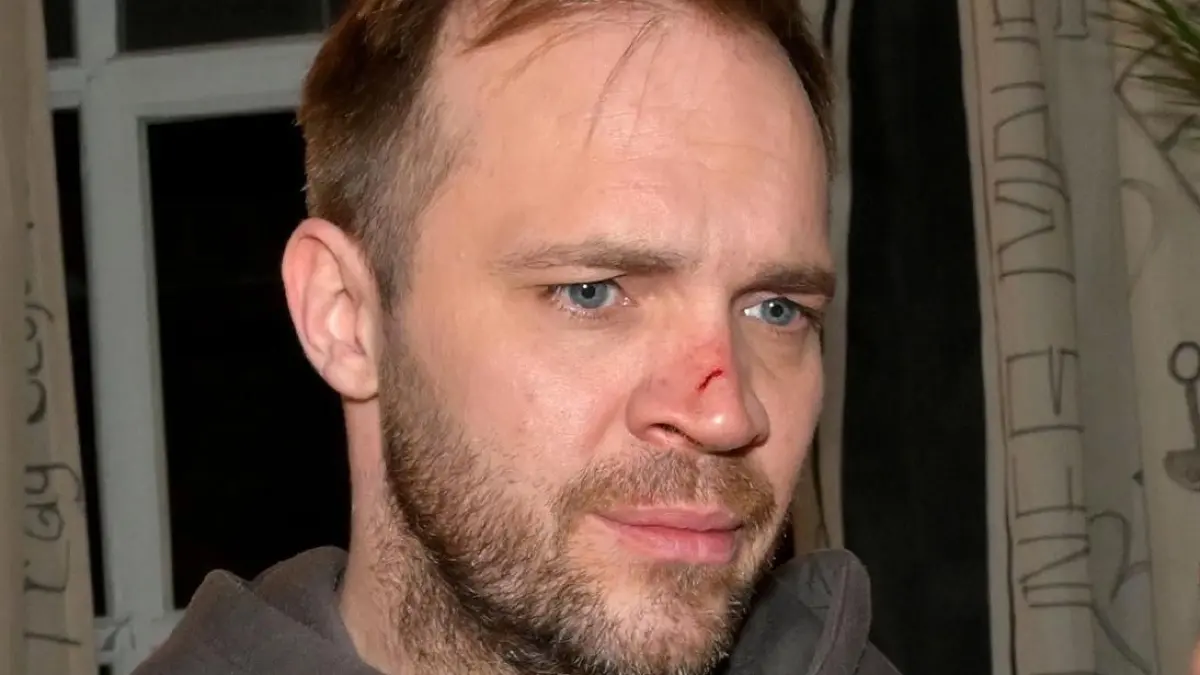 Erik (Patrick Heinrich) wird an der Nase verletzt.