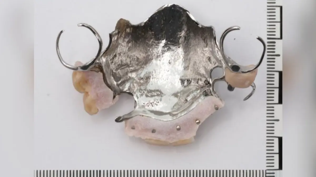 Oberkieferprothese des Opfers.