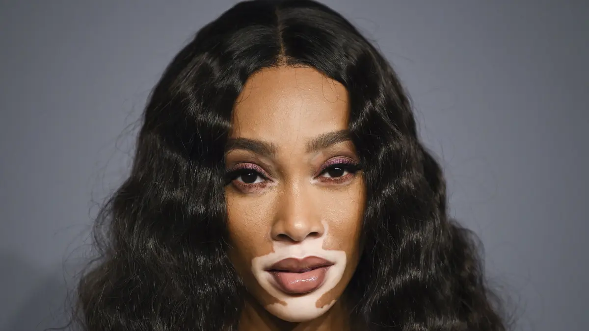 Winnie Harlow 2019 in New York.