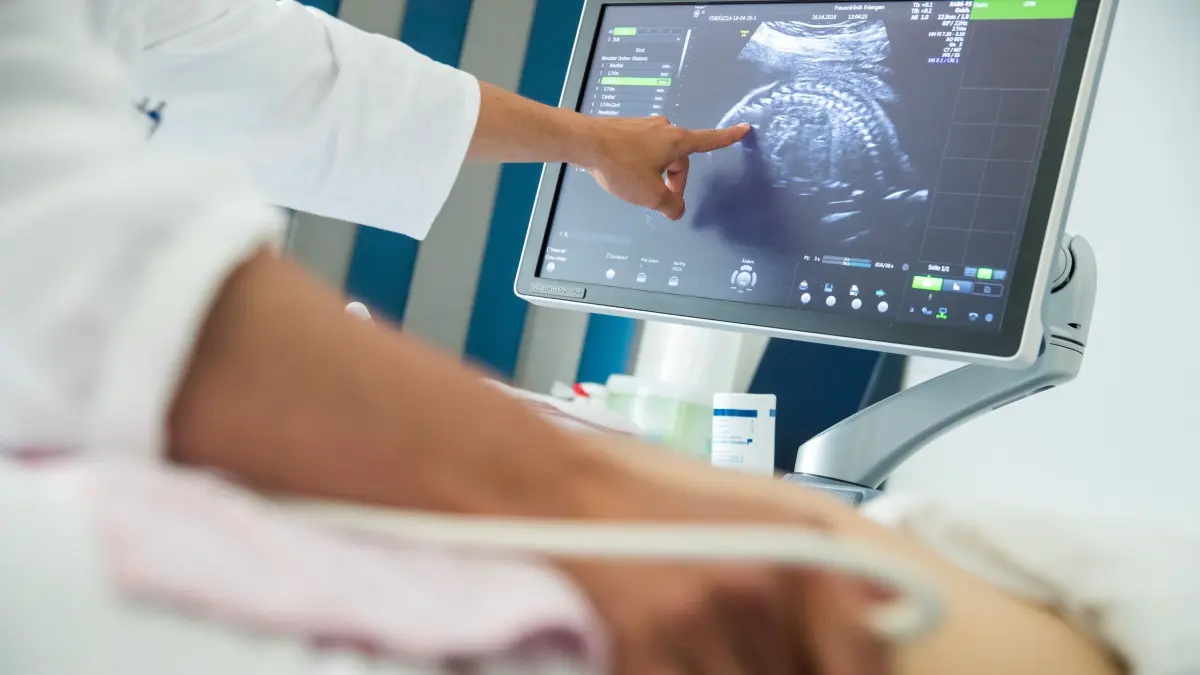 Ein Arzt führt eine Ultraschall-Untersuchung durch: ARCHIV - Wächst das Baby so, wie es soll? Darauf liefern die drei Basis-Ultraschalltermine in der Schwangerschaft Antworten. (zu dpa: «Schwanger? 4 Fakten über Ultraschalluntersuchungen») Foto: Daniel Karmann/dpa/dpa-tmn - Honorarfrei nur für Bezieher des dpa-Themendienstes +++ dpa-Themendienst +++