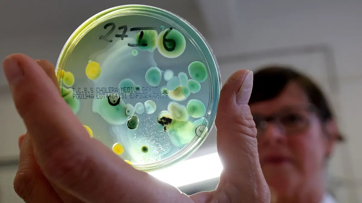 Vibrionen-Nachweis im Landesamt für Gesundheit und Soziales
